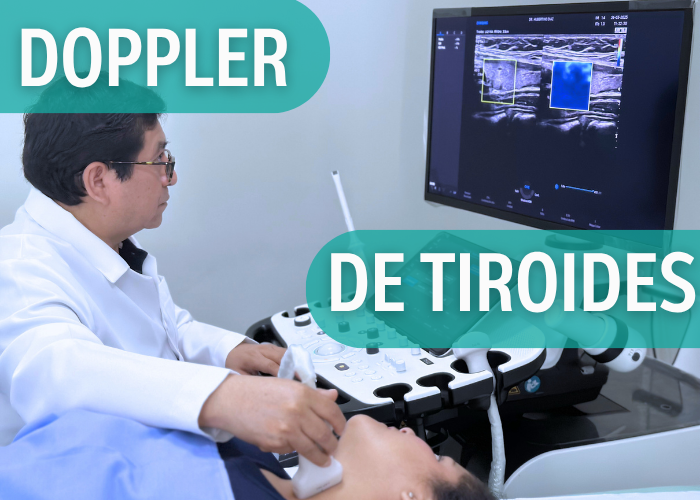 ECOGRAFÍA DOPPLER DE TIROIDES