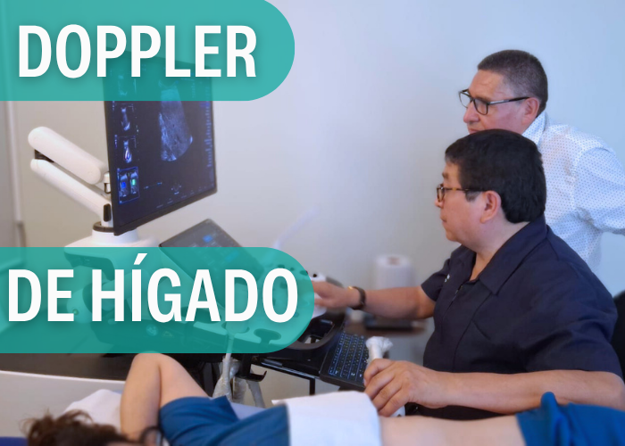 ECOGRAFÍA DOPPLER DE HÍGADO