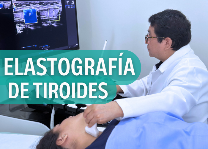 ELASTOGRAFÍA DE TIROIDES
