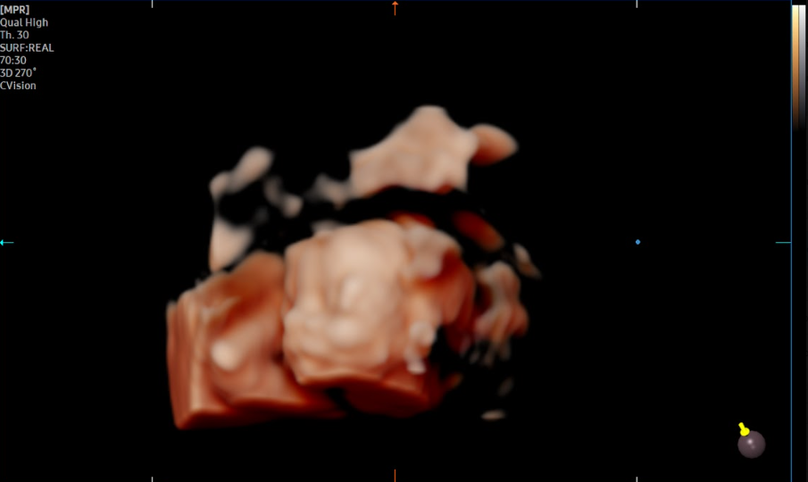 OBSTETRICIA 4D - 5D