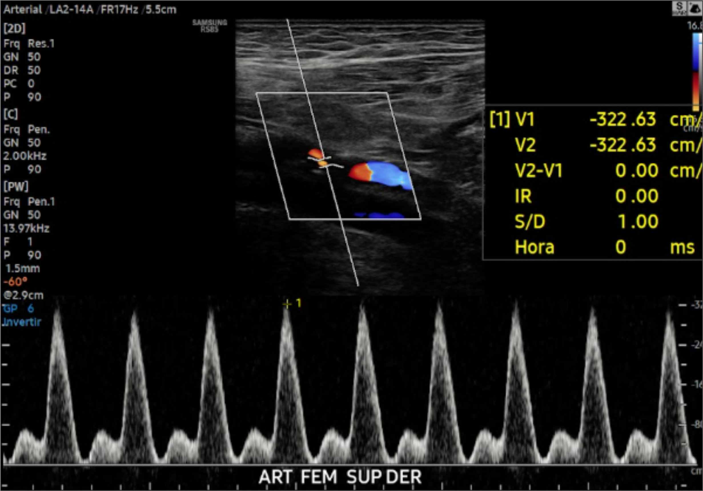 ECOGRAFÍA VASCULAR
